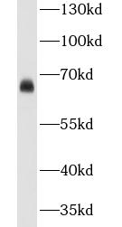CA9 antibody|CA9抗体 FNab01153