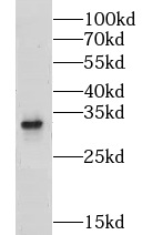 CLEC2D antibody|CLEC2D抗体