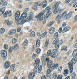 LRCH1 antibody|LRCH1抗体