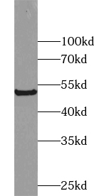 ZNF446 antibody|ZNF446抗体