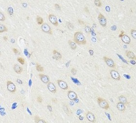 CRABP2 antibody|CRABP2抗体