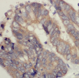 KAZN antibody|KAZN抗体