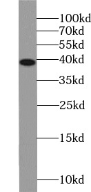 PHC2 antibody|PHC2抗体