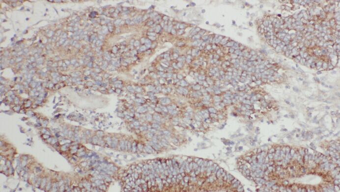 A4GNT antibody|A4GNT抗体