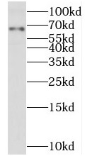 TMX3 antibody|TMX3抗体