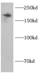Collagen Type IV antibody|Coll