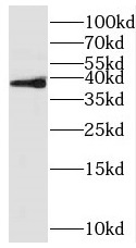 RFFL antibody|RFFL抗体