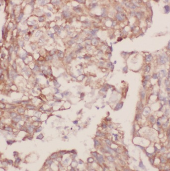 CSK antibody|CSK抗体 FNab02016