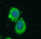 ATP2A2 antibody|ATP2A2抗体 FNab0