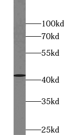 VASH1 antibody|VASH1抗体