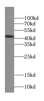 SEPTIN5 antibody|SEPTIN5抗体