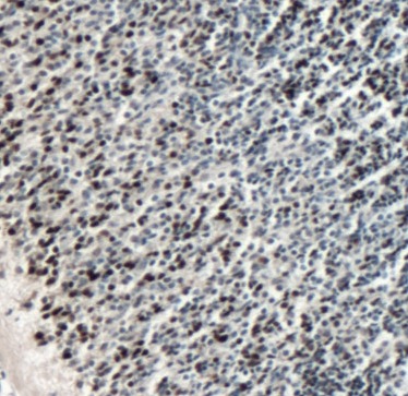 PAX6 antibody|PAX6抗体