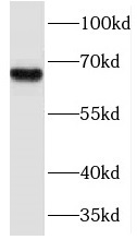 NFE2L1 antibody|NFE2L1抗体 FNab0