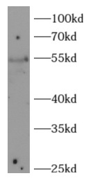 KLF4 antibody|KLF4抗体 FNab10038