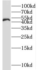 NLE1 antibody|NLE1抗体