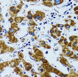 PRDX3 antibody|PRDX3抗体 FNab063