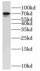 NUAK2 antibody|NUAK2抗体