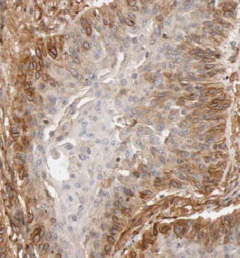 KLHL14 antibody|KLHL14抗体 FNab0