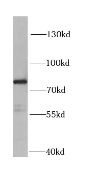 HADHA antibody|HADHA抗体 FNab037