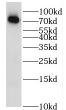 IL2RB antibody|IL2RB抗体
