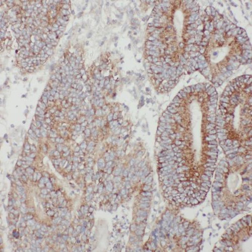 TMF1 antibody|TMF1抗体