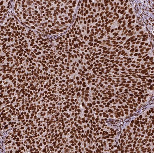 RPP25 antibody|RPP25抗体