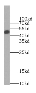 GLA antibody|GLA抗体 FNab00329