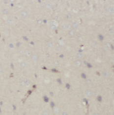 ATP2B2 antibody|ATP2B2抗体