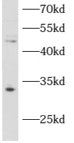 ATAD1 antibody|ATAD1抗体