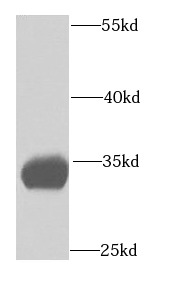 ETFA antibody|ETFA抗体
