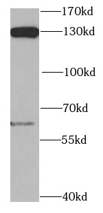 POLD1 antibody|POLD1抗体