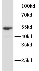 KRT7 antibody|KRT7抗体 FNab02218