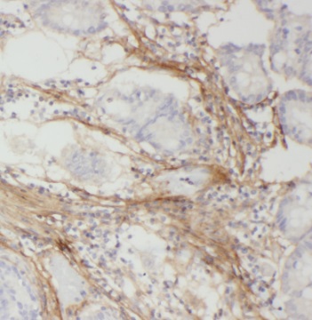 PSMC4 antibody|PSMC4抗体