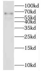 IKZF3 antibody|IKZF3抗体 FNab042