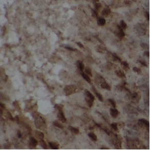 WEE1 antibody|WEE1抗体