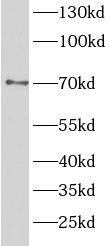 TAB2 antibody|TAB2抗体 FNab09979