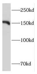CPS1 antibody|CPS1抗体 FNab01935