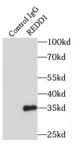 PSME3 antibody|PSME3抗体