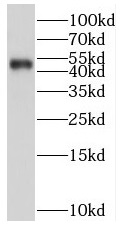 RGMA antibody|RGMA抗体