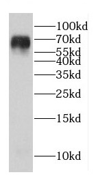 CDK5RAP1 antibody|CDK5RAP1抗体