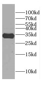CENPP antibody|CENPP抗体