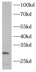 INMT antibody|INMT抗体