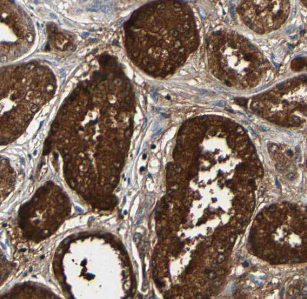 FKBP4 antibody|FKBP4抗体 FNab031