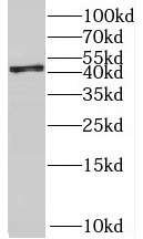 RBM17 antibody|RBM17抗体 FNab071