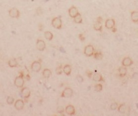 SLC1A3 antibody|SLC1A3抗体