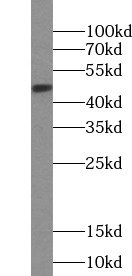 PTGER3 antibody|PTGER3抗体 FNab0