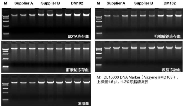 磁珠法血液DNA提取试剂盒（预封装）（DM102）