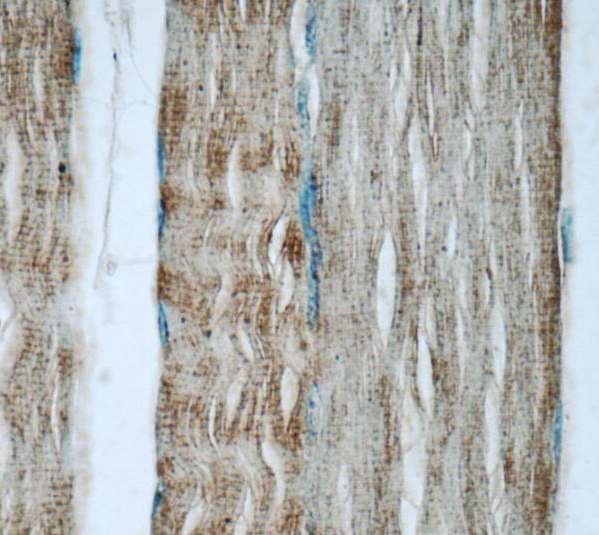 TNNT3 antibody|TNNT3抗体