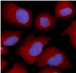 PSMC4 antibody|PSMC4抗体