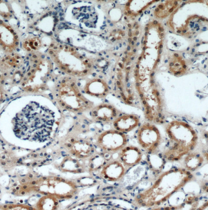 FOXO4 antibody|FOXO4抗体 FNab032